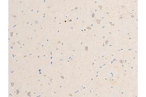 ABIN6267071 at 1/100 staining human heart tissue sections by IHC-P.