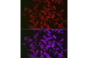Immunofluorescence analysis of SH-SY5Y cells using C Rabbit pAb (ABIN6130035, ABIN6137891, ABIN6137892 and ABIN6220925) at dilution of 1:100 (40x lens).