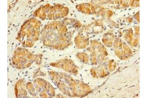Immunohistochemistry of paraffin-embedded human pancreatic tissue using ABIN7159422 at dilution of 1:100 (MESP1 anticorps  (AA 149-268))