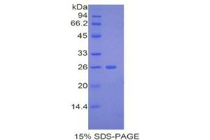 SDS-PAGE analysis of Mouse ADAMTS12 Protein. (ADAMTS12 Protéine)