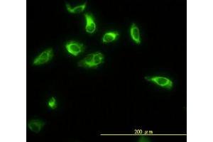 Image no. 4 for anti-Thiopurine S-Methyltransferase (TPMT) (AA 1-246) antibody (ABIN598985) (TPMT anticorps  (AA 1-246))