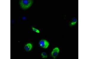Immunofluorescence staining of MCF-7 cells with ABIN7175718 at 1:166, counter-stained with DAPI. (WDPCP anticorps  (AA 621-737))