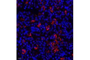 Immunofluorescence of paraffin embedded rat hypophysis using TSH (ABIN7075906) at dilution of 1:400 (400x lens)