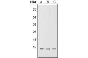 Western blot analysis of CD252 expression in A549 (A), NS-1 (B), H9C2 (C) whole cell lysates. (TNFSF4 anticorps  (Center))