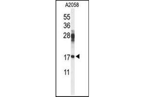 Western blot analysis in A2058 cell line lysates (35 ug/lane) using RPS11 Antibody (Center) Cat. (RPS11 anticorps  (Middle Region))
