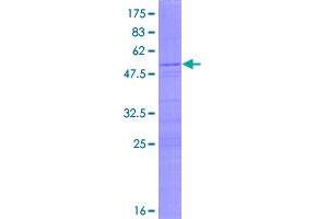 Image no. 1 for Ribosomal Protein S8 (RPS8) (AA 1-208) protein (GST tag) (ABIN1318855)