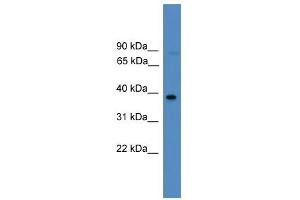 WB Suggested Anti-FOSL2 Antibody Titration:  0.