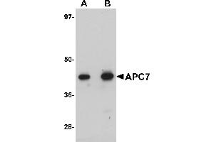 Western Blotting (WB) image for anti-Anaphase Promoting Complex Subunit 7 (ANAPC7) (C-Term) antibody (ABIN1030245) (ANAPC7 anticorps  (C-Term))