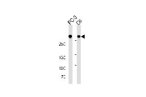 FLNA Antibody (ABIN1882243 and ABIN2838478) western blot analysis in PC-3 and C6 cell line lysates (35 μg/lane). (Filamin A anticorps  (AA 1-360))