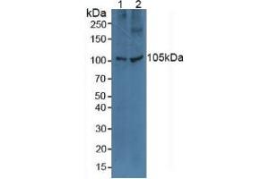 Western blot analysis of (1) Human A549 Cells and (2) Human HeLa cells. (TLR5 anticorps  (AA 46-205))