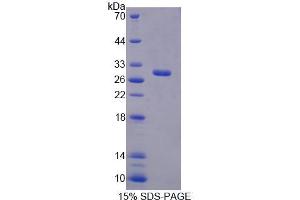 SDS-PAGE analysis of Mouse RFC4 Protein. (RFC4 Protéine)