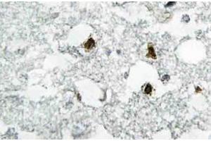 Immunohistochemistry (IHC) analyzes of p27 antibody in paraffin-embedded human brain tissue. (CDKN1B anticorps)