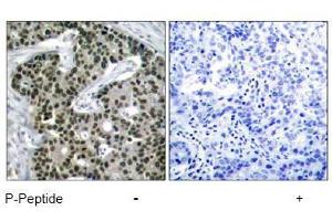 Image no. 1 for anti-Heat Shock Factor Protein 1 (HSF1) (pSer303) antibody (ABIN197025) (HSF1 anticorps  (pSer303))