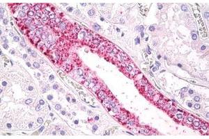Human Kidney: Formalin-Fixed, Paraffin-Embedded (FFPE) (FFAR2 anticorps  (Cytoplasmic Domain))