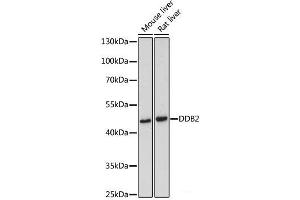 Western blot analysis of extracts of various cell lines using DDB2 Polyclonal Antibody at dilution of 1:500. (DDB2 anticorps)