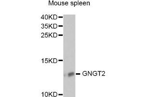 Western blot analysis of extracts of mouse spleen, using GNGT2 antibody (ABIN6292958) at 1:1000 dilution.