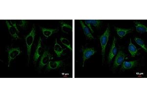 ICC/IF Image TRAP1 antibody detects TRAP1 protein at mitochondria by immunofluorescent analysis. (TRAP1 anticorps)