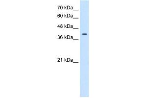 WB Suggested Anti-TSPAN12 Antibody Titration:  0. (TSPAN12 anticorps  (Middle Region))