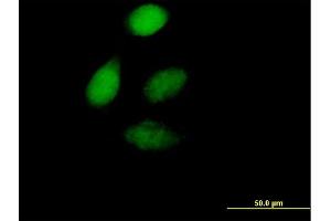 Immunofluorescence of purified MaxPab antibody to ZFP276 on HeLa cell.