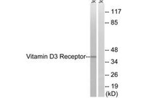 Western blot analysis of extracts from Jurkat cells, using Vitamin D3 Receptor (Ab-51) Antibody. (Vitamin D Receptor anticorps  (AA 16-65))