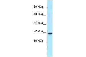 WB Suggested Anti-XAGE1D Antibody Titration: 1. (XAGE1D anticorps  (C-Term))