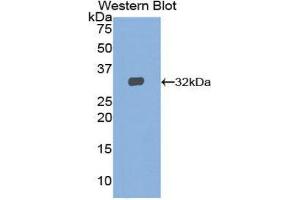 Western Blotting (WB) image for anti-Signal Transducer and Activator of Transcription 2, 113kDa (STAT2) (AA 658-912) antibody (ABIN1860647)