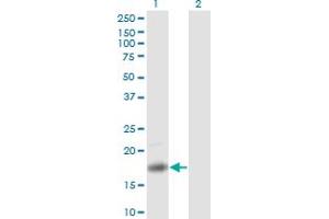 Western Blot analysis of PTN expression in transfected 293T cell line by PTN monoclonal antibody (M01), clone 5C3. (Pleiotrophin anticorps  (AA 45-154))