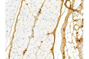 ABIN6258140 and ABIN6275931 at 1/100 staining Rat skin tissue by IHC-P.