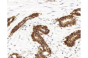 Immunohistochemistry analysis of paraffin-embedded human colon using Na+/K+-ATPase alpha1 Polyclonal Antibody at dilution of 1:300. (ATP1A1 anticorps)