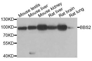 Western blot analysis of extracts of various cell lines, using BBS2 antibody. (BBS2 anticorps  (AA 1-96))