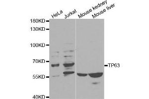 Western blot analysis of extracts of various cell lines, using TP63 antibody. (p63 anticorps  (AA 421-680))