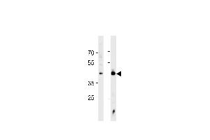 HSF1 Antibody (ABIN389069 and ABIN2839273) western blot analysis in Jurkat cell line and mouse heart tissue lysates (35 μg/lane).