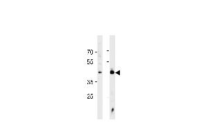 HSF1 Antibody (ABIN389069 and ABIN2839273) western blot analysis in Jurkat cell line and mouse heart tissue lysates (35 μg/lane). (HSF1 anticorps  (Sumoylation Site))