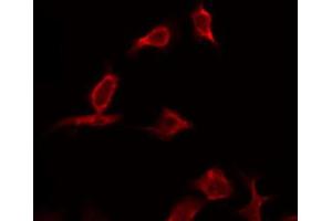 ABIN6268792 staining HeLa by IF/ICC. (Caspase 9 anticorps  (Cleaved-Asp330))