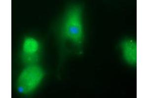 Image no. 1 for anti-UDP-GlcNAc:BetaGal beta-1,3-N-Acetylglucosaminyltransferase 2 (B3GNT2) antibody (ABIN1496799)
