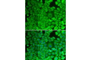 Immunofluorescence analysis of HeLa cells using GYS1 antibody.