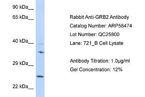 Western Blotting (WB) image for anti-Growth Factor Receptor-Bound Protein 2 (GRB2) (N-Term) antibody (ABIN2787701) (GRB2 anticorps  (N-Term))