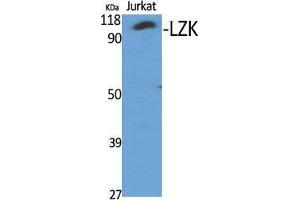 Western Blot (WB) analysis of specific cells using LZK Polyclonal Antibody.