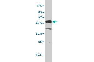 LCK monoclonal antibody (M01), clone 3F7-F5 Western Blot analysis of LCK expression in Jurkat .