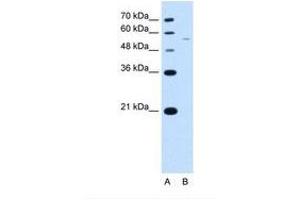 Image no. 2 for anti-arginine/serine-Rich Coiled-Coil 2 (RSRC2) (AA 363-412) antibody (ABIN321837) (RSRC2 anticorps  (AA 363-412))