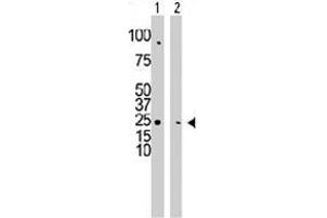 The CMPK1 polyclonal antibody  is used in Western blot to detect CMPK1 in HepG2 cell lysate (Lane 1) and mouse cerebellum tissue lysate (Lane 2) . (Cytidine Monophosphate (UMP-CMP) Kinase 1, Cytosolic (CMPK1) (C-Term) anticorps)
