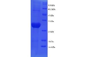 SDS-PAGE (SDS) image for Plexin A1 (PLXNA1) (AA 32-296), (partial) protein (His tag) (ABIN5712902)