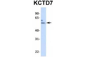 Host:  Rabbit  Target Name:  KCTD7  Sample Type:  Human Fetal Heart  Antibody Dilution:  1. (KCTD7 anticorps  (N-Term))