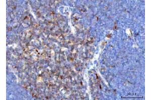 IHC analysis of TCR alpha/TRAC using anti-TCR alpha/TRAC antibody (ABIN6719654). (TRAC anticorps  (AA 1-114))