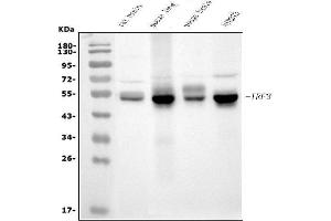 Western blot analysis of IRF3 using anti-IRF3 antibody (ABIN7599372).
