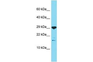 Host: Rabbit Target Name: C16orf87 Sample Type: OVCAR-3 Whole Cell lysates Antibody Dilution: 1. (C16ORF87 anticorps  (N-Term))