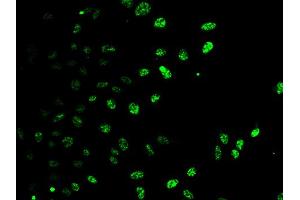 Immunofluorescence analysis of HeLa cells using E2F6 antibody. (E2F6 anticorps)