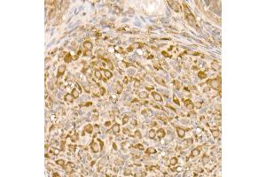 Immunohistochemistry of paraffin-embedded human colon carcinoma using TOM20 Rabbit mAb (ABIN7268554) at dilution of 1:100 (40x lens).
