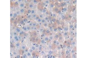 IHC-P analysis of Rat Tissue, with DAB staining. (CD8 alpha anticorps  (AA 26-236))