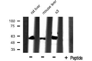Western blot analysis of extracts of various celllines,using HSP60 antibody. (HSPD1 anticorps)